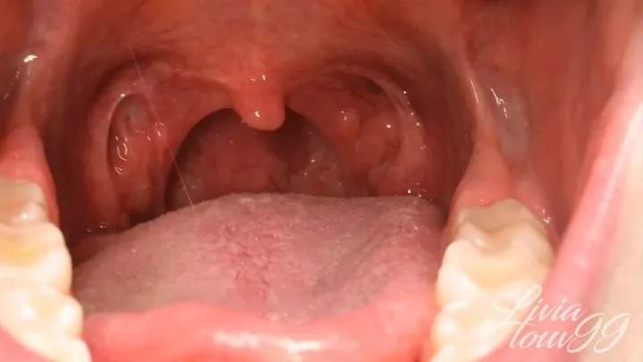 Close up uvula, swollen tonsils and yawning