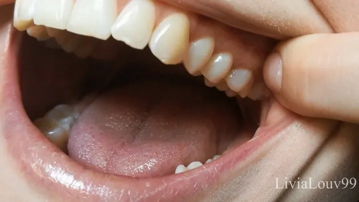 My teeth tour for you