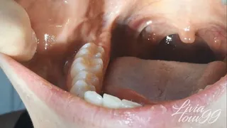 Gums, jaws, teeth and uvula