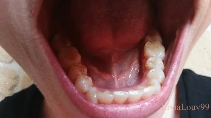 Explore my mouth and teeth