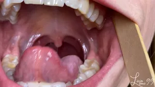 Mouth, teeth, tongue, uvula exploration