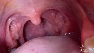 Uvula closeup