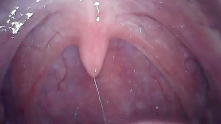 YAWNING MAGICIAN HARBOURED HIS TINY BODY INSIDE MY PUSSY - UVULA (NO SOUND)