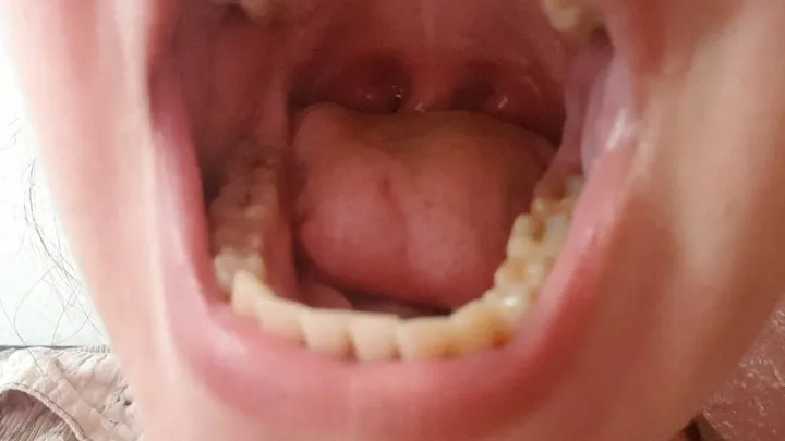 look inside my mouth