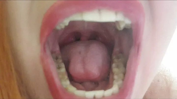 Inside the mouth