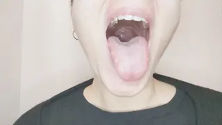 Totally exposing my uvula