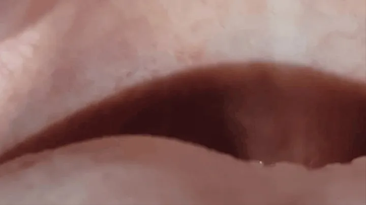 Inside My Mouth