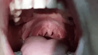 Uvula Extreme Close Up