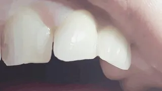 Early Morning Teeth Extreme Close Up