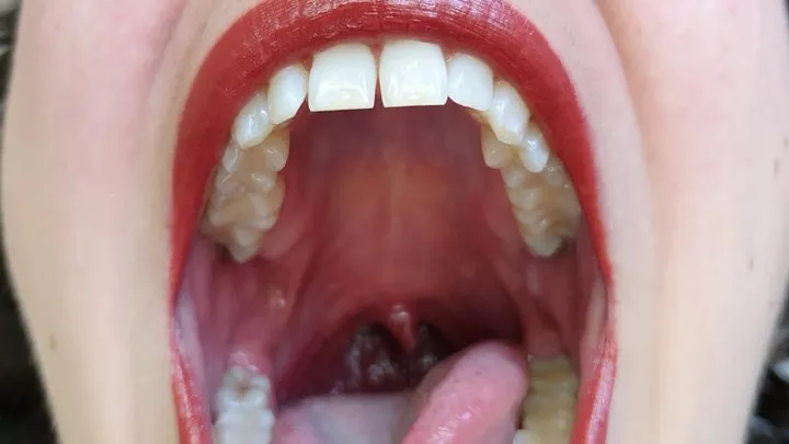 Watch My Uvula - Custom Request