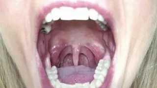 STRETCHING MOUTH