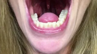 ANOTHER DAY INSIDE MY MOUTH