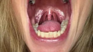 CLEAR LOOK INSIDE MY MOUTH