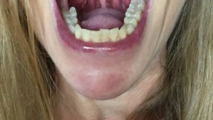 LONG UVULA?