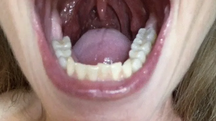 UVULA DANCING TO TUNES