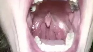 DANCING UVULA