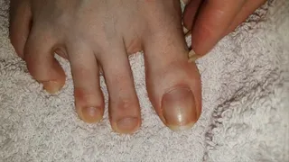 Cut long nails on feet 2