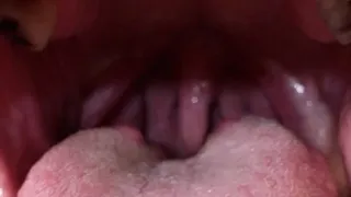 3D UVULA