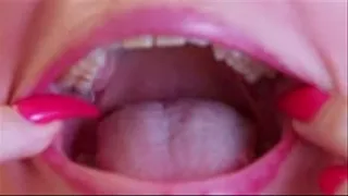 Mouth Inspection Part 1 Home