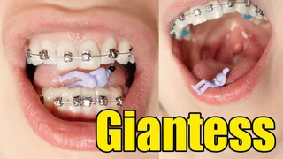 Giantess with Braces and little you