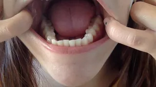 Strong teeth