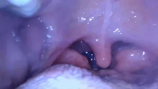 Throat Exam