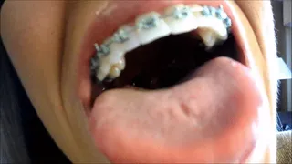 FAT Tongue