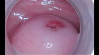 Beautiful Cervix and Inside Pussy - BTS No Audio