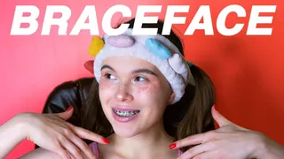 Braceface Teen Metal Braces Review