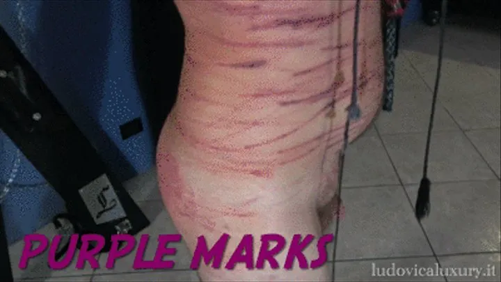 PURPLE MARKS (WHIPPING)