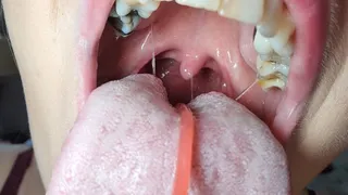 Gummy String Throat Tease