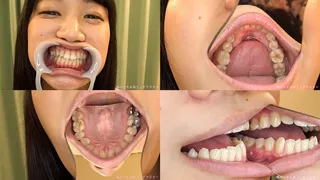 Maki - Watching Inside mouth of Japanese enchanting girl