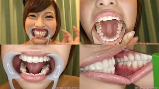 Mizuki - Watching Inside mouth of Japanese erotic girl