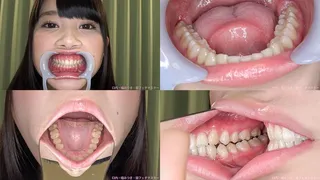 Aya - Watching Inside mouth of Japanese cute girl