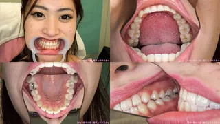 Ena - Watching Inside mouth of Japanese attractive girl BITE-39-1