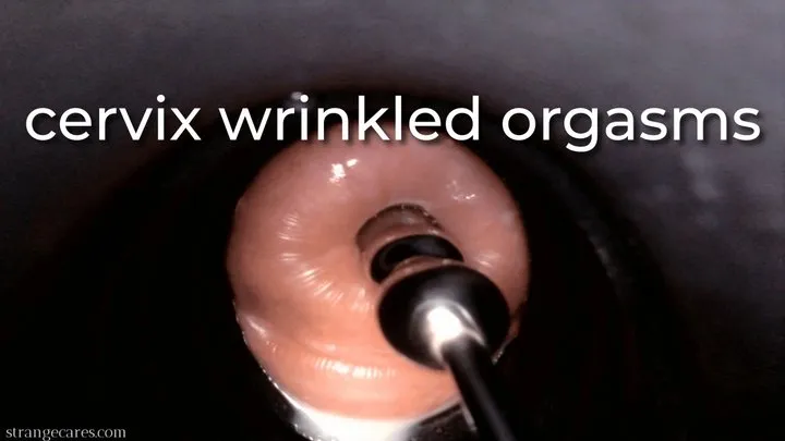 cervix wrinkled orgasms - uncaptioned