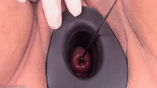 cervix sounding compilation