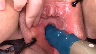 stronic in my peehole for the first time