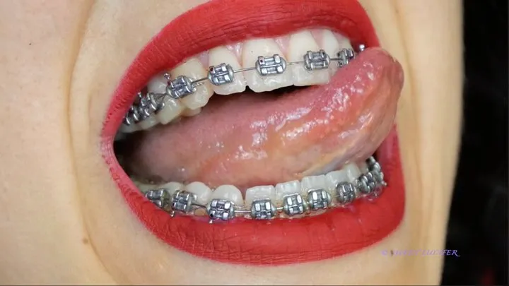 Braces and red lipstick