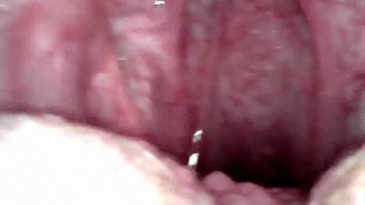 Endoscope in my throat 1