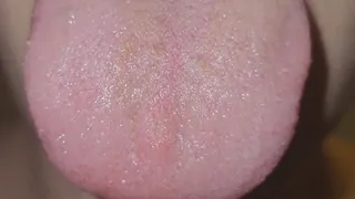 Coated tongue up close