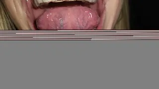 Retainers teeth tongue movements