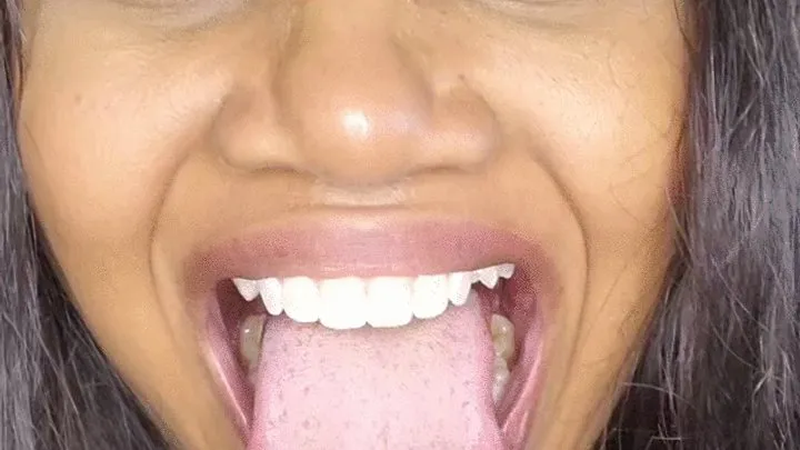 Mouth