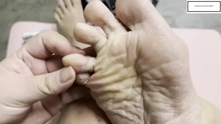 Simplytiffany Debuts her itchy athletes foot