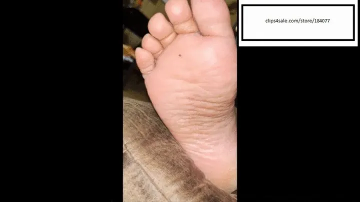 Delicious Itching Athletes Foot UP CLOSE