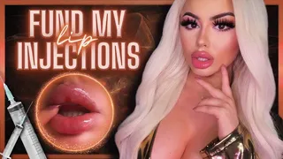 Fund My Lip Injections