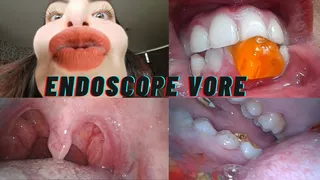 Vore close up with Endoscope