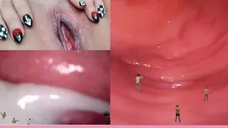 Giantess pussy endoscopy vs micro nan