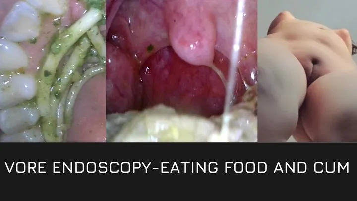 Vore endoscopy eating food