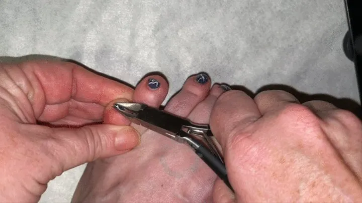 Toenail Trimming and Collecting